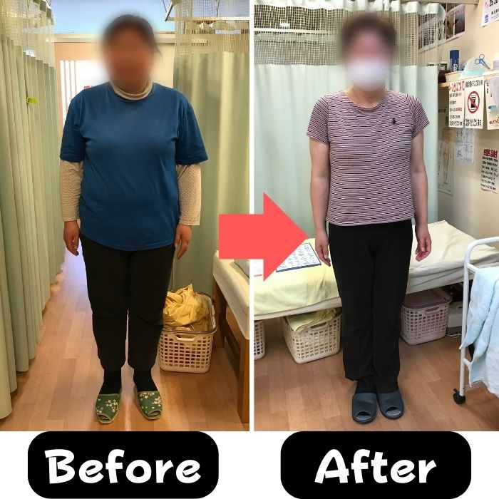 47歳女性 ダイエット前後 正面 78.3kgから68.8kg
