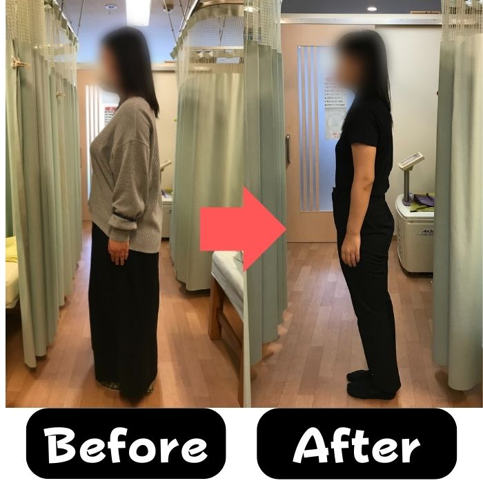 34歳女性 ダイエット前後 横向き