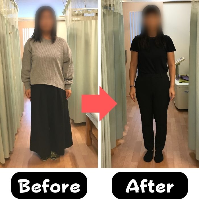 34歳女性 ダイエット前後 正面 80.4kgから60.3kg